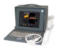 Ультразвуковой сканер «Сономед-500» цветной