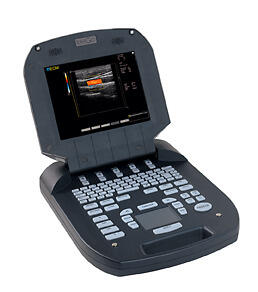 Портативный ультразвуковой сканер EXAGO