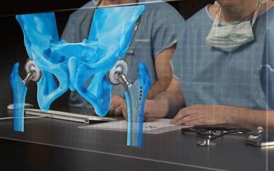 «ТРЕК-Э Композит» более 30 лет проектирует и изготавливает эндопротезы тазобедренного сустава 