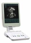 Ультразвуковой сканер Flex Focus 1202 B-K Medical