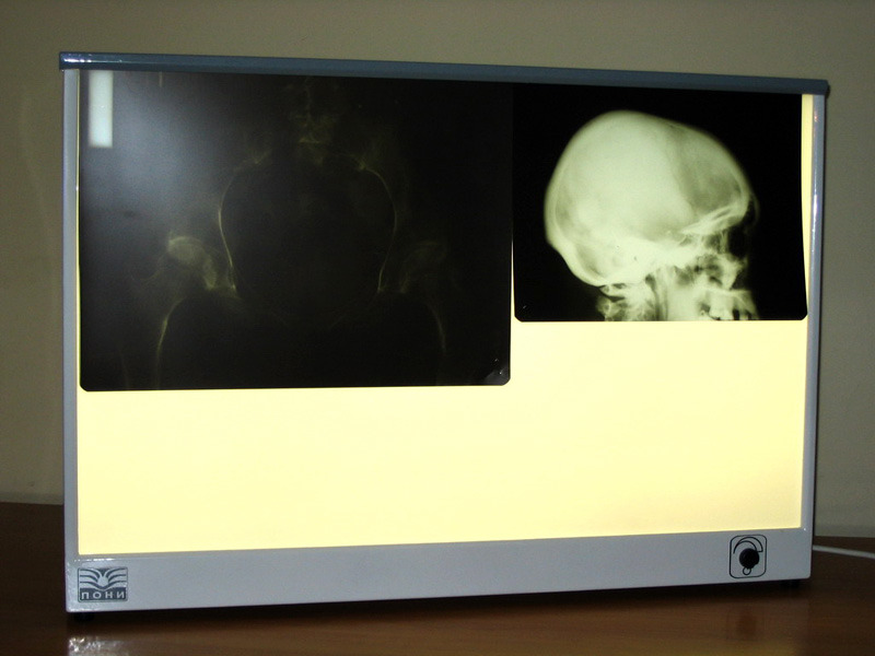 Негатоскопы Негатоскопы